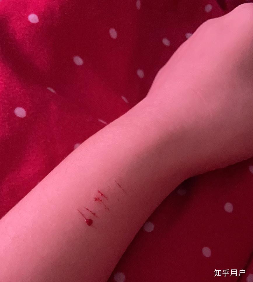 垂首難得，皆因要抹。挑戰自我是自殘打一准确生肖警惕虚假宣传、全面解答与解释、精准解答解释落实